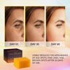 Picture of VALITIC Kojic Acid Soap for Hyperpigmentation - with Glutathione, Collagen & Vitamin C - Natural Soap Bars with Turmeric - Original Japanese Complex for Dark Spot Correction - 3 Pack