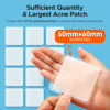 Picture of TKTK Large Pimple Patches, 60 mm XL Acne Patches, Big Hydrocolloid Bandages for Body, Face, Forehead, Chin, Neck Zit Breakouts, Hydrocolloid Patch (Square, Strip, Dot 5 Sizes 62 Count)