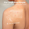 Picture of TKTK Large Pimple Patches, 60 mm XL Acne Patches, Big Hydrocolloid Bandages for Body, Face, Forehead, Chin, Neck Zit Breakouts, Hydrocolloid Patch (Square, Strip, Dot 5 Sizes 62 Count)