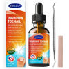 Picture of Ingrown Toenail Relief: Ingrown Toenail Tool for Men Women - Ingrown Toenail Removal Kit - Ingrown Toenail Corrector Drops - Ingrown Toenail Remover - Effective Solution for Ingrown Toenails - 30ml