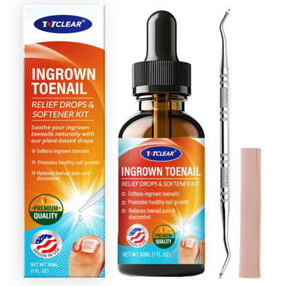 Picture of Ingrown Toenail Relief: Ingrown Toenail Tool for Men Women - Ingrown Toenail Removal Kit - Ingrown Toenail Corrector Drops - Ingrown Toenail Remover - Effective Solution for Ingrown Toenails - 30ml