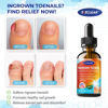 Picture of Ingrown Toenail Relief: Ingrown Toenail Tool for Men Women - Ingrown Toenail Removal Kit - Ingrown Toenail Corrector Drops - Ingrown Toenail Remover - Effective Solution for Ingrown Toenails - 30ml