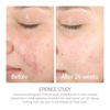 Picture of Epionce Lytic Gel Cleanser - Face Wash & Makeup Remover for Combination to Oily & Problem Skin, Oily Skin Facial Cleanser with Willow Bark & Menthol, Dermatologist Skincare