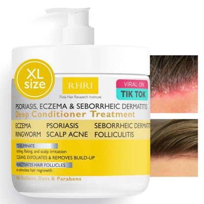 Picture of Rida Hair Research Institute Antifungal Psoriasis Shampoo (After Shampoo Conditioner)