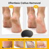Picture of BEZOX Glass Foot Scrubber Shower(1 PCS) - Nano-Glass Pedi Egg Pumice Stone for Feet Dead Skin, Plastic-Free Pedicure Foot File Callus Remover - Bamboo Handle