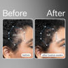 Picture of Act+Acre 3-Pack Mini Cold Processed Stem Cell Scalp Serum - Promotes Thicker and Fuller-Looking Hair - Soothes and Hydrates the Scalp - Sulphate and Paraben Free - Aloe Vera for Improved Scalp Health.