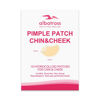 Picture of Large Acne Pimple Patches for Face, Chin, Back and Body (10 Counts), Spot Dots Cover by Albatross Health New England, Hydrocolloid Treatment Stickers, Zit Blemish Patch