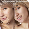 Picture of Large Acne Pimple Patches for Face, Chin, Back and Body (10 Counts), Spot Dots Cover by Albatross Health New England, Hydrocolloid Treatment Stickers, Zit Blemish Patch