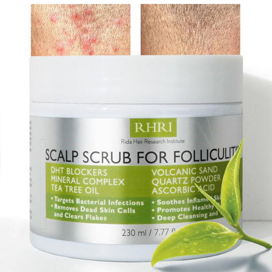 Picture of Scalp Scrub for Folliculitis | Exfoliating Hair Scrub for Dry Scalp and Folliculitis | Clarifying Detox with Tea Tree Oil, Dye and Paraben Free Formula | Exfoliator Scrub Targets Bacterial Infections