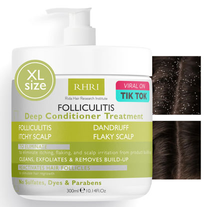 Picture of Folliculitis Deep Conditioner | Effective Scalp Treatment for Seborrheic Dermatitis, Psoriasis, Dry Itchy Scalp, Dandruff Treatment | Nourishes Oily Hair and Promotes Healthy, Hydrated Hair Treatment