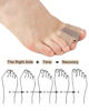 Picture of Golbylicc Bunion Toe Separators for Overlapping Toes Women Men, Gel Toe Spacers Bunion Corrector with 2 Loops for feet (4PC)