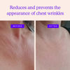 Picture of Chest Wrinkle Pads - Silicone Patches for Wrinkles - Overnight Anti Wrinkle Patches, Anti Aging Silicone Wrinkle Patches Reusable - Neck & Décolleté, Skin Safe Chest Wrinkle Patches (1-mo Supply)