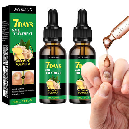 Picture of Ginger Nail Treatment Nail Support Nail Care, 7days Nail Treatment, Ginger Nail Growth Serum, Ginger Cuticle Care Oil for Nails,Cuticle Serum for Nails (2Pcs, 1 Fl.oz(pack of 1))