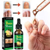 Picture of Ginger Nail Treatment Nail Support Nail Care, 7days Nail Treatment, Ginger Nail Growth Serum, Ginger Cuticle Care Oil for Nails,Cuticle Serum for Nails (2Pcs, 1 Fl.oz(pack of 1))
