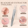 Picture of WSYUB Blackhead Tweezers, Pimple Popper Tool Kit, Blackhead Extractor,Ingrown Hair Tweezers, Blemish and Blackhead Removal Tools