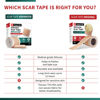 Picture of Medical Grade Silicone Scar Tape Advanced Adhesive Formulation (1.6" x 118") Scar Removal Away Strips for Surgical Scars, Silicone Tape & Keloid Scar Treatment, Reusable Silicone Scar Sheets