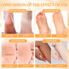 Picture of Foot Pedicure Spa Set,Foot Soak Spa Home Pedicure Kit with Bath Salt, Moisturizing Foot Scrub Cream Lotion, Foot Care for Dead Skin, Dry Cracked Feet, Make Baby Soft Feet, 3 Set