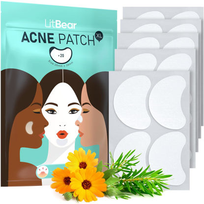 Picture of LitBear Acne Patches Large, Hydrocolloid Pimple Patches for Large Breakouts, Zit and Blemish, Large Acne Patches for Face, Chin, Back and Body with Tea Tree & Calendula Oil