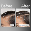 Picture of ACT+ ACRE Cold Processed Stem Cell Scalp Serum - Promotes Thicker and Fuller-Looking Hair - Soothes and Hydrates the Scalp - Sulphate and Paraben Free - Aloe Vera for Improved Scalp Health - 1 fl oz.