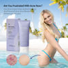 Picture of Butt Acne Clearing Treatment, Maximum Strength Body Cream for Back, Buttocks, Thigh & Chest Acne Removal, Skin Clearing Lotion for Men & Women, Foaming Cleanser for Bacne & Cystic Acne