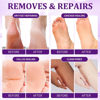 Picture of nbc BeautiLab Pedicure Kit Foot Soak Set: Bubble Salt, Sugar Scrub, Massage Mask, Massage Lotion in a Box, 4 Step Foot Spa Kit for Dry Feet, Softens Calluses, Tired Feet（3 Set Lavender)