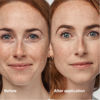 Picture of Clinique Even Better Clinical Serum Full Coverage Hydrating Foundation Broad Spectrum SPF 25 With Vitamin C, Salicylic Acid + Hyaluronic Acid For Oily Skin Types, Alabaster, 1 Fl Oz