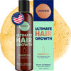 Picture of Moerie Ultimate Hair Growth Shampoo - For Longer, Thicker, Fuller Hair - Vegan Friendly Volumizing Hair Products - Paraben & Silicone Free - All Hair Types - Reverse Hair Loss - 8.45 fl oz (250ml)