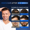 Picture of Hair Growth Serum, 5% Minохidil & Biоtin for Men and Women, Stop Hair Loss and Thinning, Natural Organic Growing Spray for Hair Regrowth, All Hair Types, 2 Fl Oz
