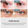 Picture of Dr.Melaxin TX Tranexamic Acid Retinalsome Eye Cream with Adenosine Niacinamide for Fine Lines, Wrinkles & Dark Spots | Daily Anti-Aging Under Eye Care | 40g - Korean Skincare