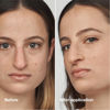 Picture of Clinique Even Better Clinical Serum Full Coverage Hydrating Foundation Broad Spectrum SPF 25 With Vitamin C, Salicylic Acid + Hyaluronic Acid For Oily Skin Types, Cream Chamois, 1 Fl Oz