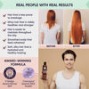 Picture of Moerie Ultimate Hair Growth Conditioner - For Longer, Thicker, Fuller Hair - Vegan Friendly Volumizing Hair Products - Paraben & Silicone Free - All Hair Types - Reverse Hair Loss - 8.45 fl oz (250ml)