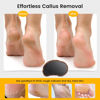 Picture of BEZOX Glass Foot Scrubber(1 PCS) - Nano-Glass Pedi Egg Pumice Stone for Feet Dead Skin, Plastic-Free Pedicure Foot File Callus Remover for Silky Smooth Feet - Walnut Wood Handled