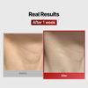 Picture of Wrinkle-fit Neck Mask 7EA + Boosting Roller - Neck Wrinkle Patches, Neck Firming and Tightening Korean Deep Collagen Mask - Neck-Targeted Mesh Sheet Mask and Face Roller for Lifting Sagging Skin