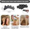 Picture of SUNFATT Toe Spacers for Men ang Women,Toe Separators for Women,Relieves Overlapping Toes,Bunions Corrector and Hammer Toe Pain,Gel Toe Spreader Separates and Relaxes Toes.2 Pcs