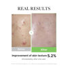 Picture of Medicube Exosome Cica Tea Tree Ampoule for Sensitive Skin with Centella Asiatica help reduce redness and breakouts. Low-irritating, Moisturizing & Soothing Serum | Korean Skincare | 30ml