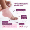 Picture of Dr. Frederick's Original Moisturizing Fuzzy Heel Socks - 2 Pairs - Cozy Gel-Lined Sleep Socks for Women & Men - Soothing Dry, Cracked Feet - Cracked Heel Repair - Heal Dry Heels - Relaxing Rose