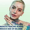 Picture of BodyJ4You Piercing Bump Treatment Keloid Bump Removal | Nose Piercing Cleaner Ear Piercing Cleaning Solution | Bump Shrinking Drops Keloid Bump Removal | Aftercare Piercing Solution | 2 x 0.33 Fl Oz