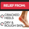 Picture of Moisturizing Socks | Cracked Heel Treatment with Aloe Vera | Moisturizer Foot Callus Remover | Aloe Socks for Cracked Heels & Dry Cracked Feet | Lotion Infused Gel Heel Socks (Fits Most)