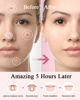 Picture of TKTK Pimple Patches Acne Patches for Face, 4 Sizes 360 Patches Hydrocolloid Acne Cover Patch, Clear Easy To Peel Acne Absorbing Zit Patch with Tea Tree & Calendula Oil