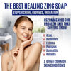 Picture of Pyrithione Zinc Soap Bar for Face & Body, 4oz | Medicated 2% ZnP Bar Soap Skin Therapy Cleanser for Acne, Rosacea, Eczema, Dermatitis, Psoriasis, Itching | Cleansing, Calming Facial Wash Made in USA