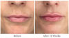 Picture of City Beauty City Lips Night Oil - Plump, Hydrate, Restore - Anti-Aging Lip Treatment - Plumping Lip Oil with Hyaluronic Acid & Plant Extracts