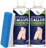 Picture of Callus Remover for Feet with Extra Strength Gel & Foot Pumice Stone Set - Easy Way to Remove Hard Calluses & Dead Skin Build-Up - Professional at-Home Foot Care for Men & Women - Made in The USA