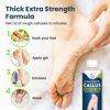 Picture of Callus Remover for Feet with Extra Strength Gel & Foot Pumice Stone Set - Easy Way to Remove Hard Calluses & Dead Skin Build-Up - Professional at-Home Foot Care for Men & Women - Made in The USA