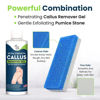 Picture of Callus Remover for Feet with Extra Strength Gel & Foot Pumice Stone Set - Easy Way to Remove Hard Calluses & Dead Skin Build-Up - Professional at-Home Foot Care for Men & Women - Made in The USA