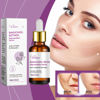 Picture of Venature Bakuchiol Retinol Rejuvenation Serum,2024 Best Retinol Serum for Wrinkles Bakuchiol Retinol Face Serum Korean, Retinol Serum for Wrinkles, Reduce Wrinkles