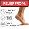 Picture of Moisturizing Socks for Women & Men | Aloe Vera Cracked Heel Treatment | Foot Callus Remover | Aloe Socks for Cracked Heels & Dry Cracked Feet | Lotion Infused Gel Heel Socks (Large - 2 Pairs)