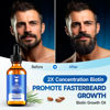 Picture of Beard Growth Oil - 2X Concentration Biotin Beard Oil for Men (2 oz) - Natural Mens Beard Oil with Argan Oil, Jojoba Oil and Vitamin, Beard Growth Softener, Moisturizer (Sandalwood)