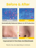 Picture of Elvira Pore Control Cleansing Oil, Makeup Remover for Sensitive, Oil Cleanser for Face, Blackhead Removal, Korean Skin care, Hydrating, Fragrance-Free