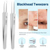 Picture of WSYUB Blackhead Remover Tweezers,Ingrown Hair Tweezers, Precision Blackhead Pimple Extractor, Cell Clips Tweezers, Tweezers for Women Facial Hair