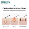 Picture of MR.GREEN Ingrown Hair Tweezers Needle Nose Pointed Tips Tweezers For Eyebrows Splinters Blackhead Removal Acne Clip Extractor (Long)
